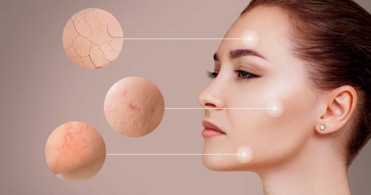 cosa può causare irritazione alla pelle