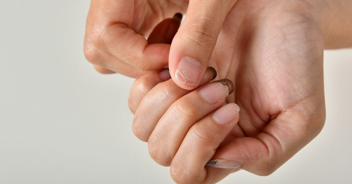 unghie che si spezzano