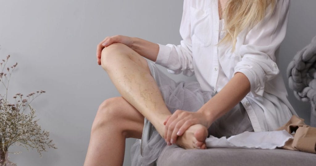 integratori per gambe gonfie