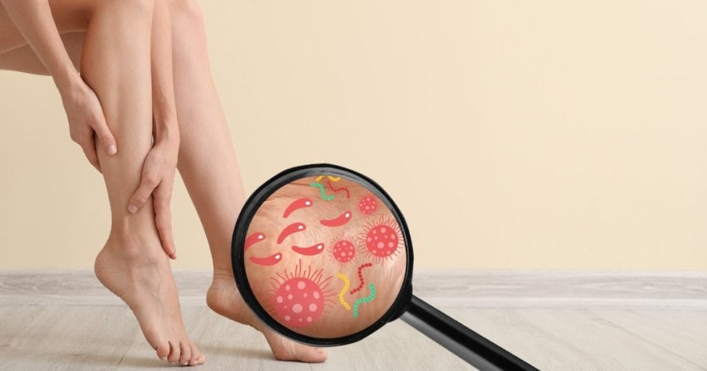 piede con lente di ingrandimento con microbi e batteri a indicare come si cura la micosi nei piedi