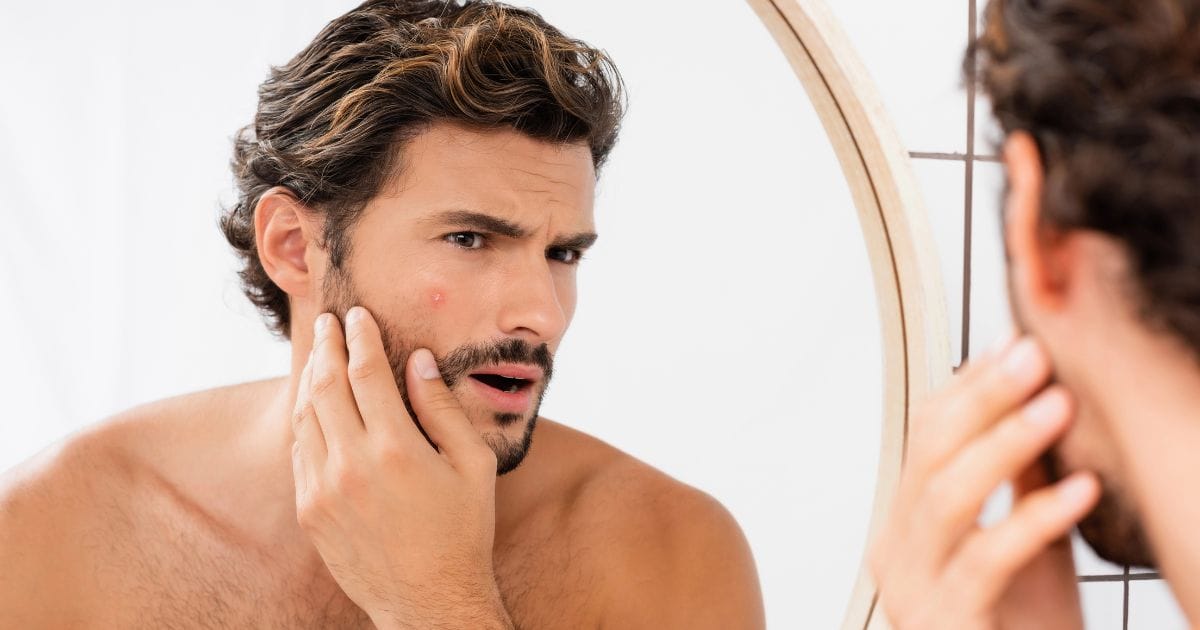 ragazzo si guarda allo specchio la pelle grassa